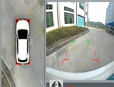 تأثير الرؤية الخلفية AVM